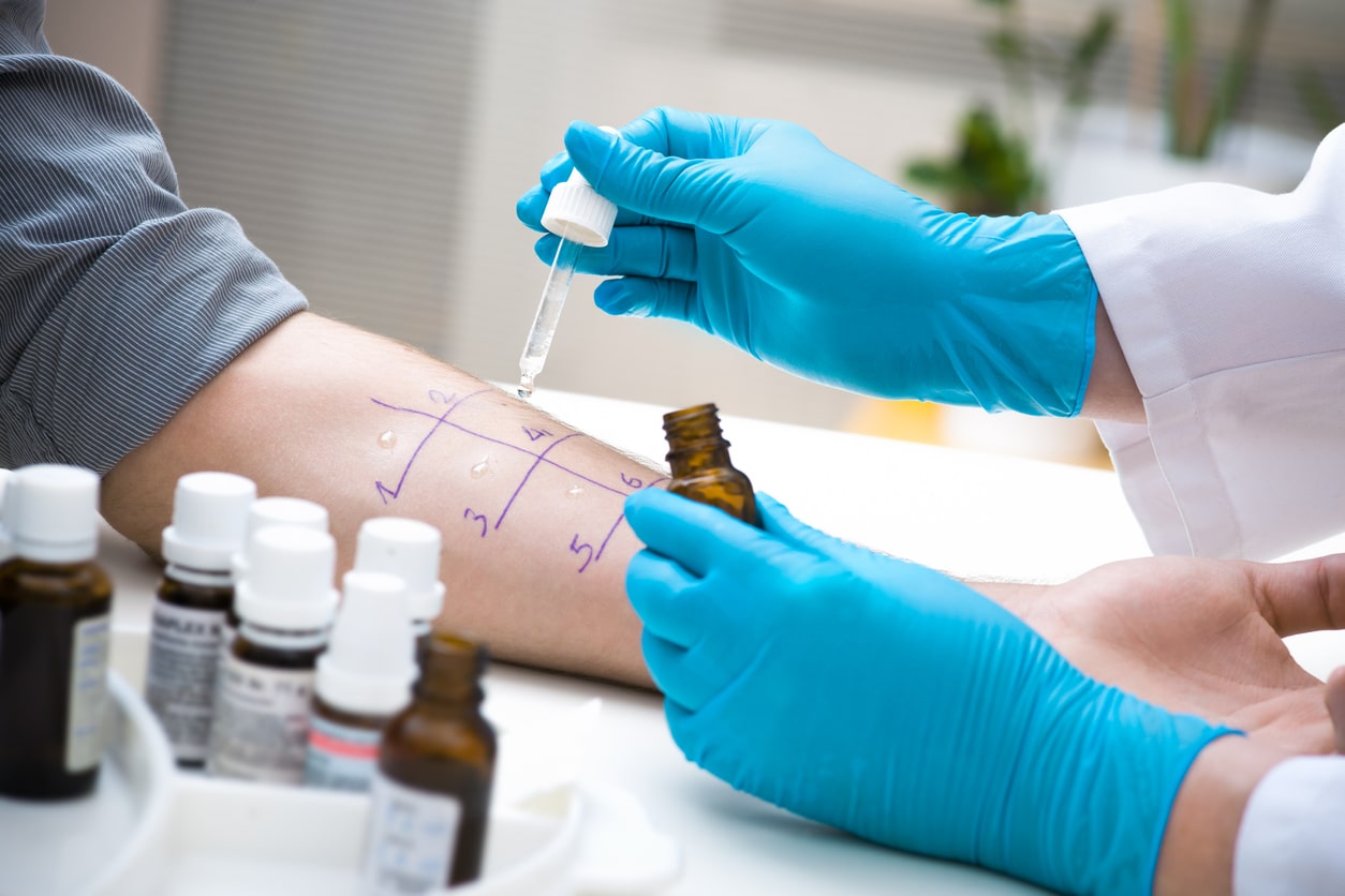 Provider administering an allergy skin test.